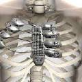 Российские ученые создали искусственные кости, подходящие любому человеку