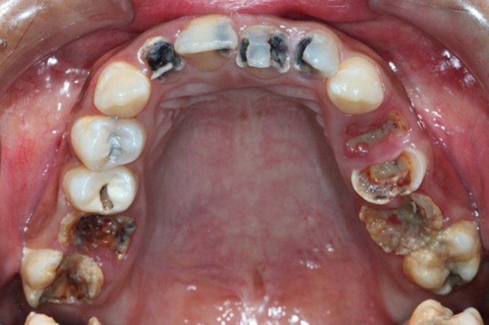 Самые нездоровые зубы