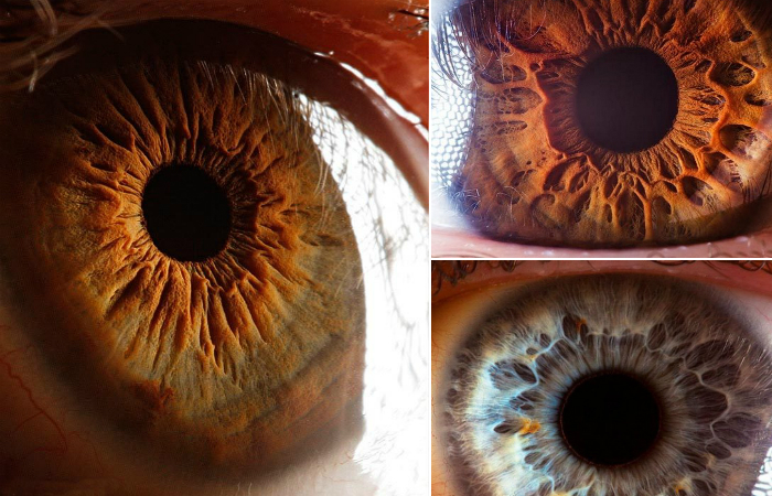Невероятные фото человеческих глаз.