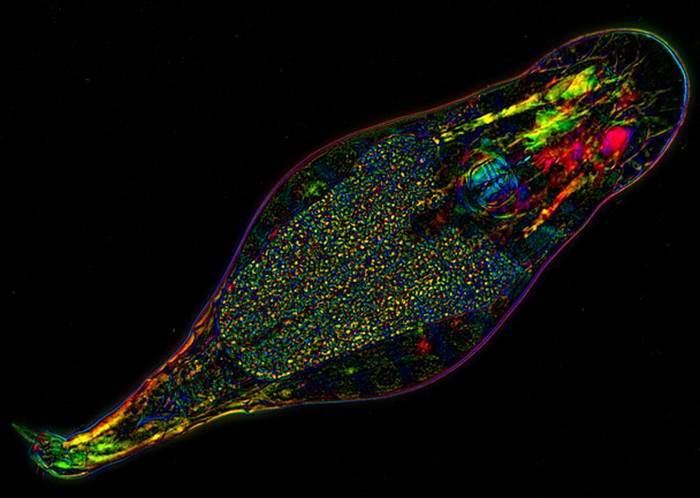 Микроскопический организм: коловратки.