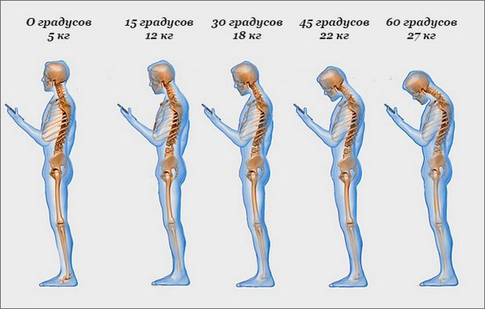 Как пользователям смартфонов и планшетов сохранить позвоночник здоровым.