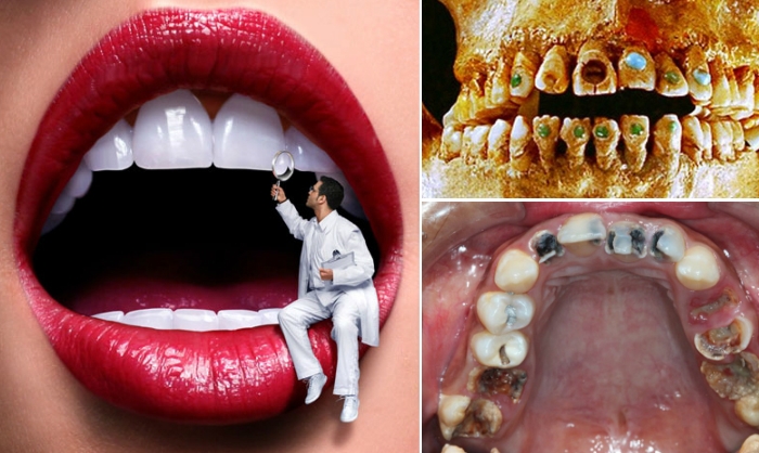 Интересные факты о зубах.