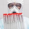 Россиян собираются массово проверять на антитела к COVID-19
